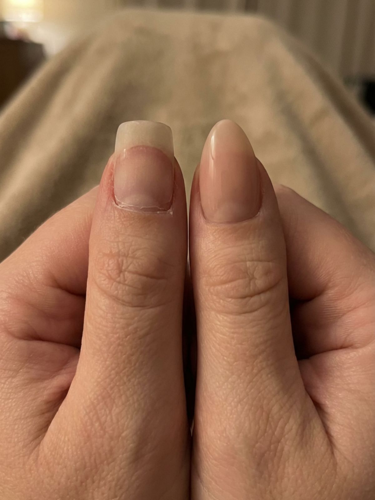 correct-vs-incorrect-press-on-sizing Common Mistakes When Using Press-On Nails - Correct sizing is crucial; a nail that is too wide will inevitably look artificial and feel uncomfortable.